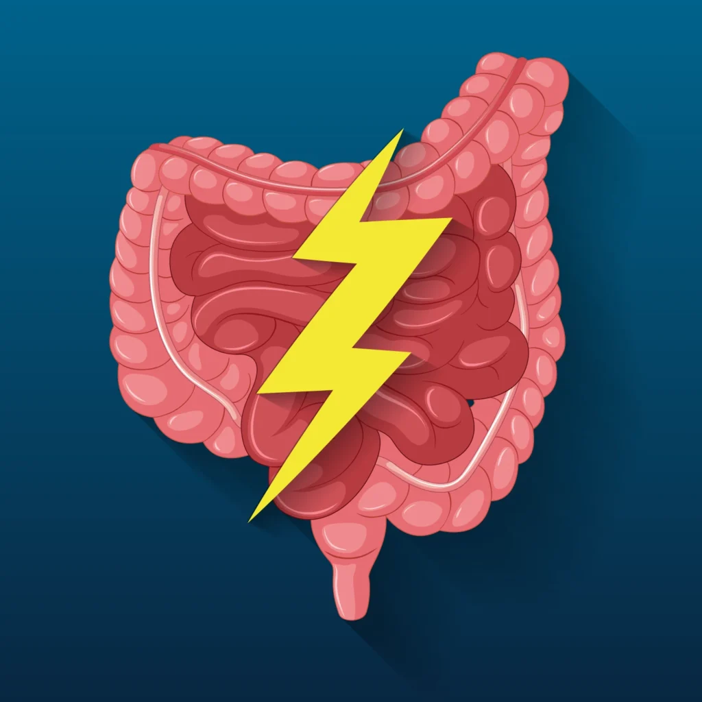 Σύνδρομο ευερέθιστου Εντερου 3